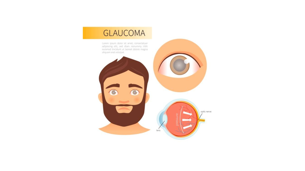 Glaucoma Diagnosis and Treatment