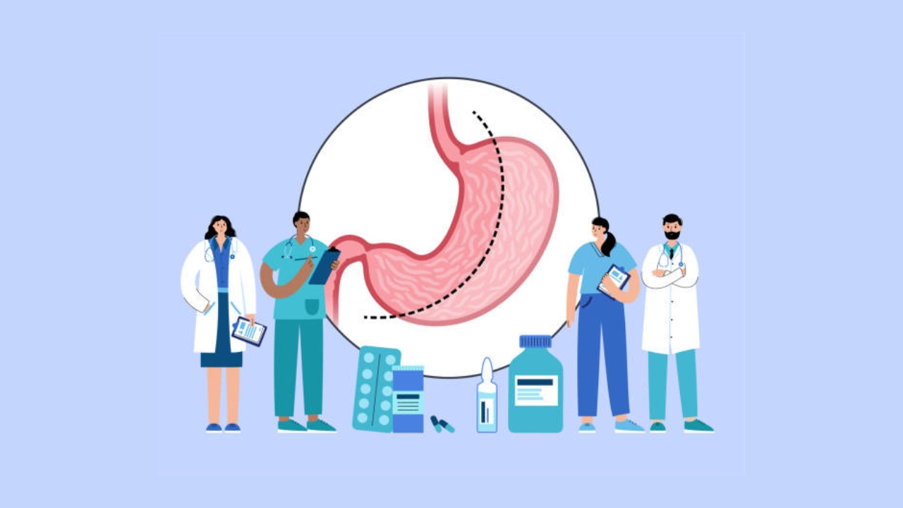 Weight Loss Surgery Overview