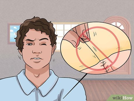 Frenuloplasty Treatment